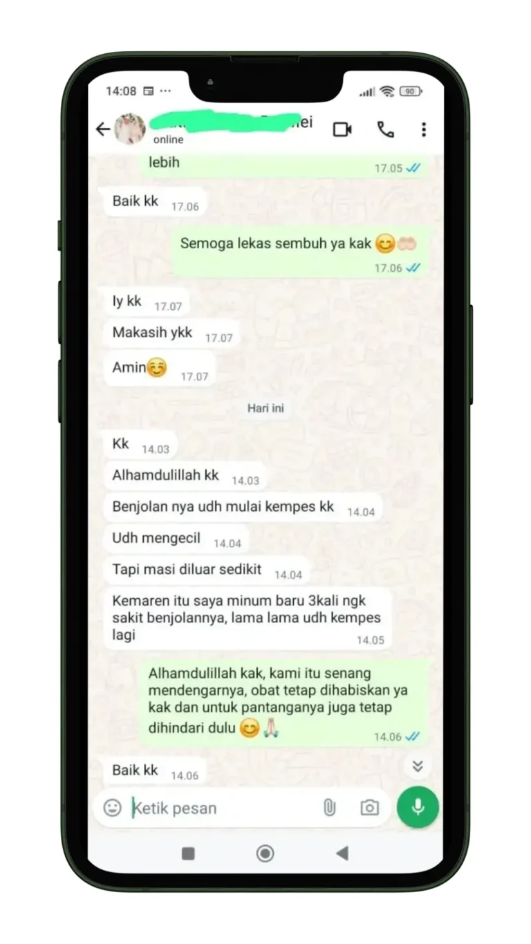 obat wasir paling ampuh - obat ampuh untuk wasir - obat wasir alami tradisional - obat wasir stadium 1 sampai 4 - obat wasir aman untuk ibu hamil - cara mengobati wasir secara alami testimoni 3