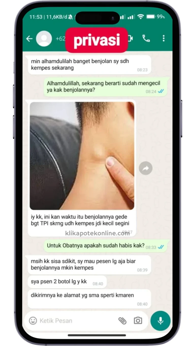 obat tumor - obat tumor ganas - obat tumor paru - obat tumor hati - obat tumor anak - obat tumor jinak - pengobatan tumor